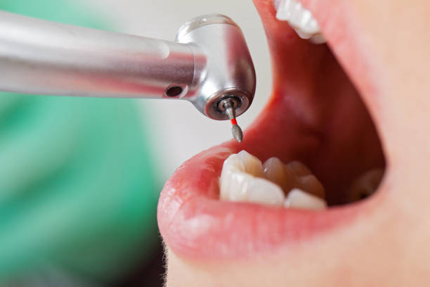 Best Emergency Pediatric Dental Care in Four Corners, MT